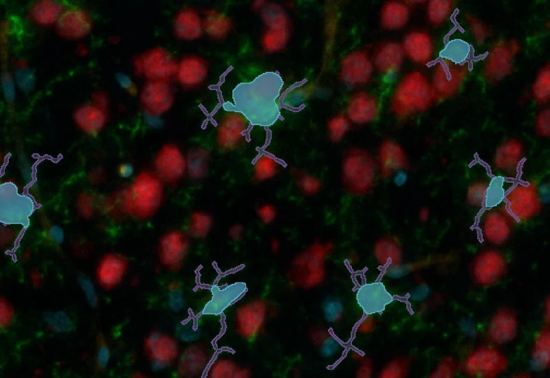 Dynamic Content Image